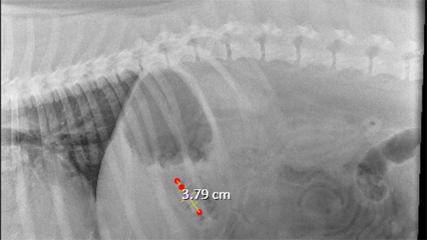 Digital radiograph of abdomen